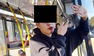 【视频】中国留学生新西兰遇袭 中方促当地警方全力缉捕凶徒